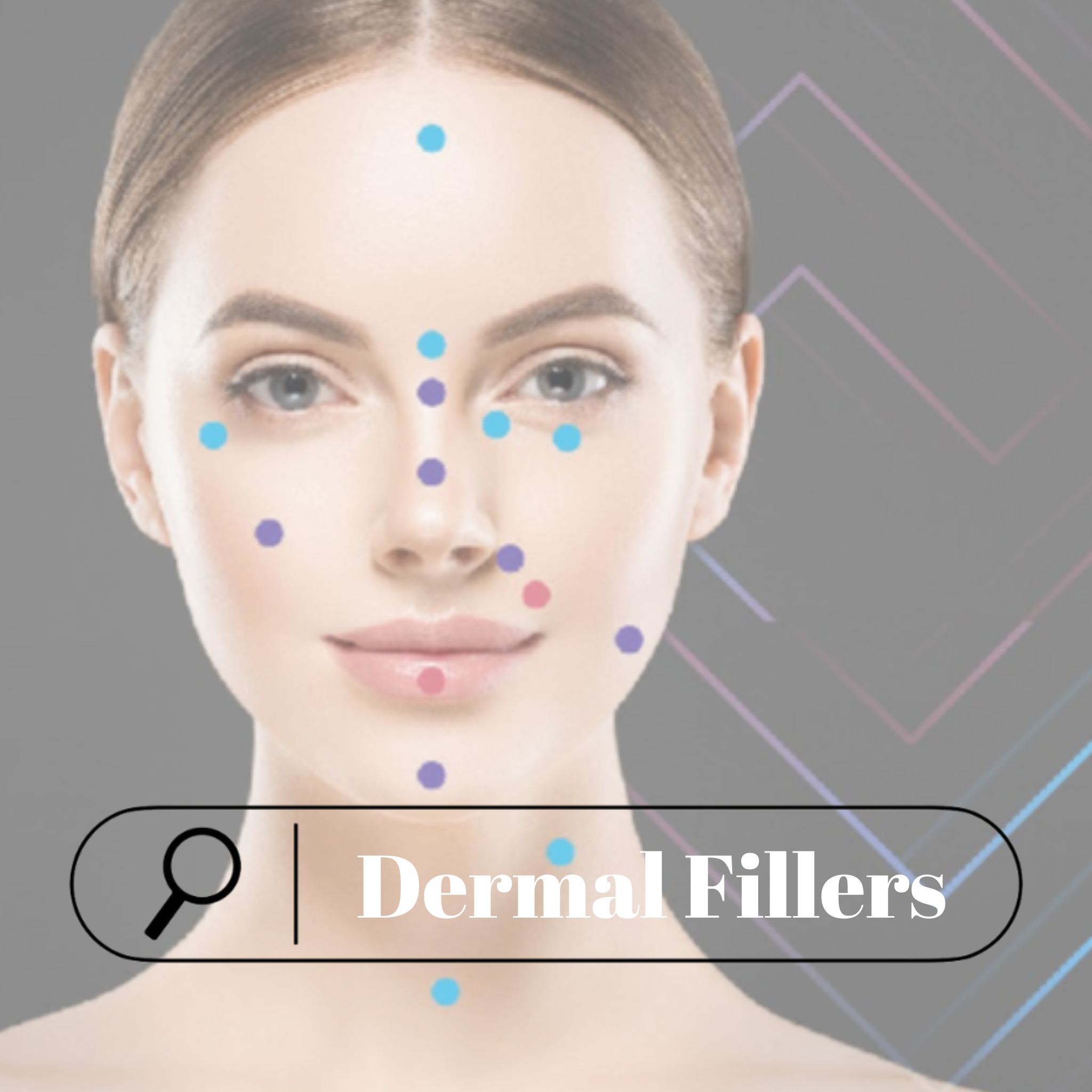 Dermal Fillers